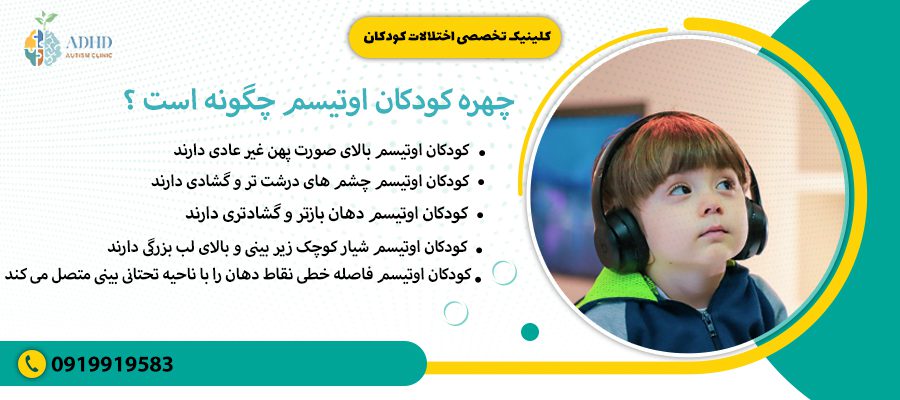 چهره کودکان اوتیسم چگونه است ؟